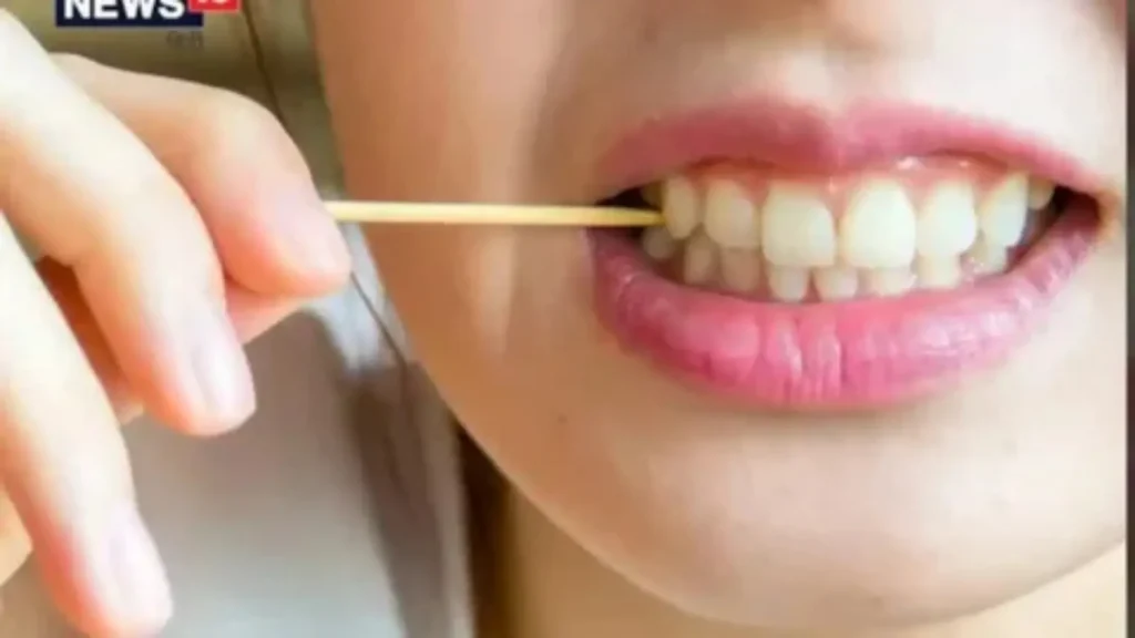 dentist pick up lines